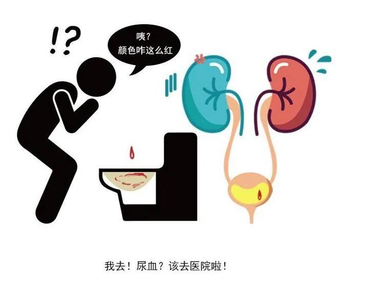 血尿有血物块什么原因,小便擦拭有血和血尿一样吗