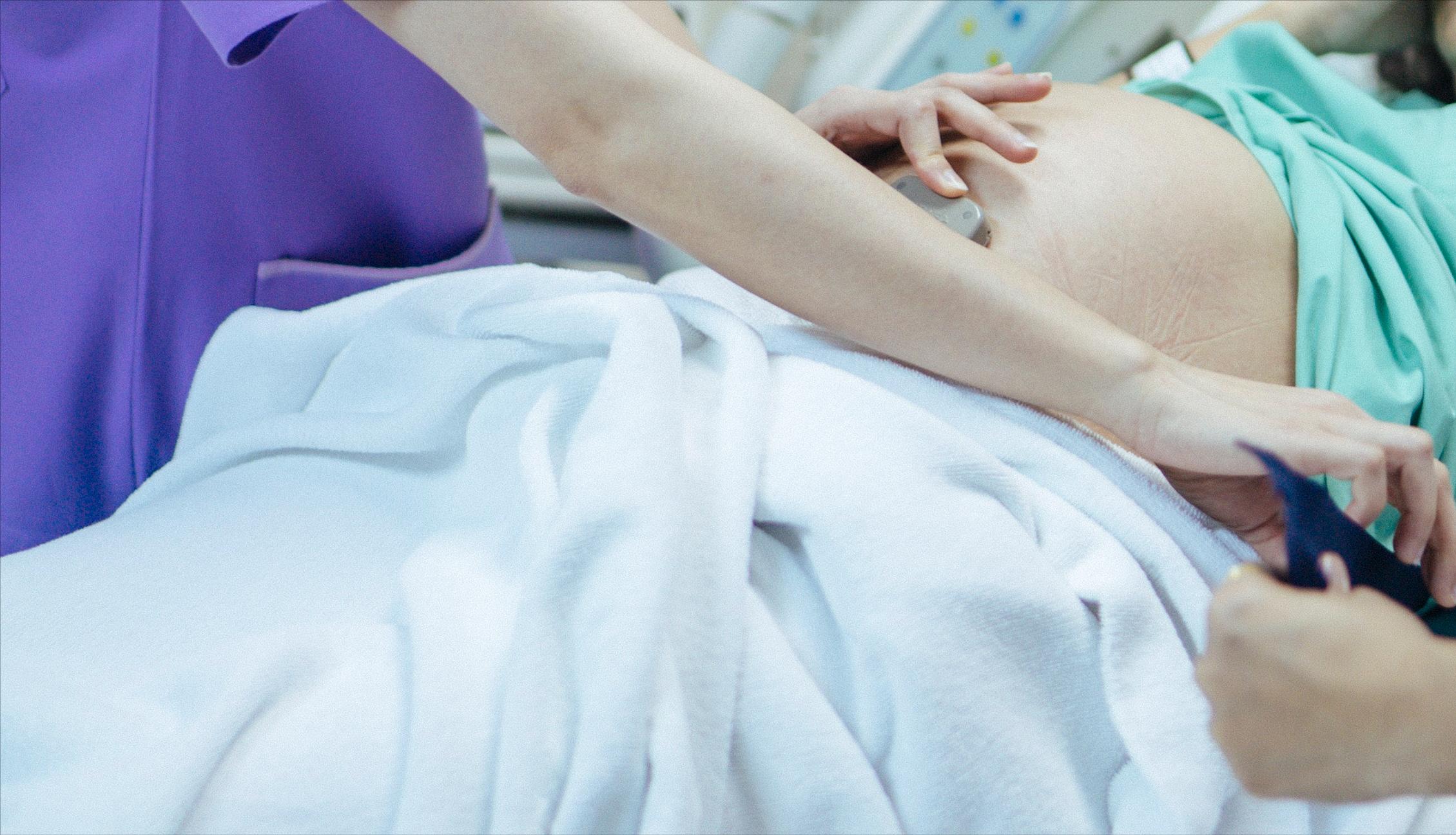 矮小症产妇一样可以享受到无痛分娩的好处了