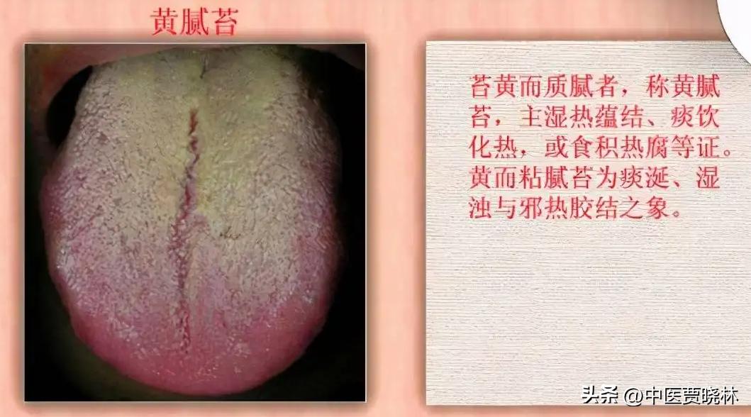 热咳吐黄痰，寒咳吐白痰，燥咳是无痰三种中成药，清热散寒止燥咳