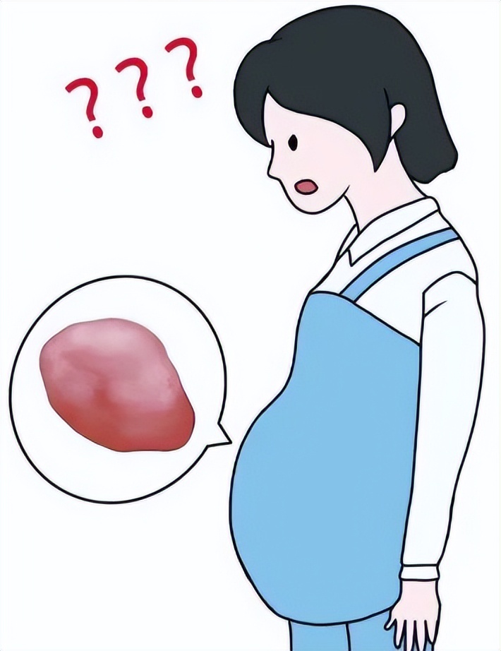 惊呆！台州16岁少女肚子一点点变大，医生竟从中取出这东西