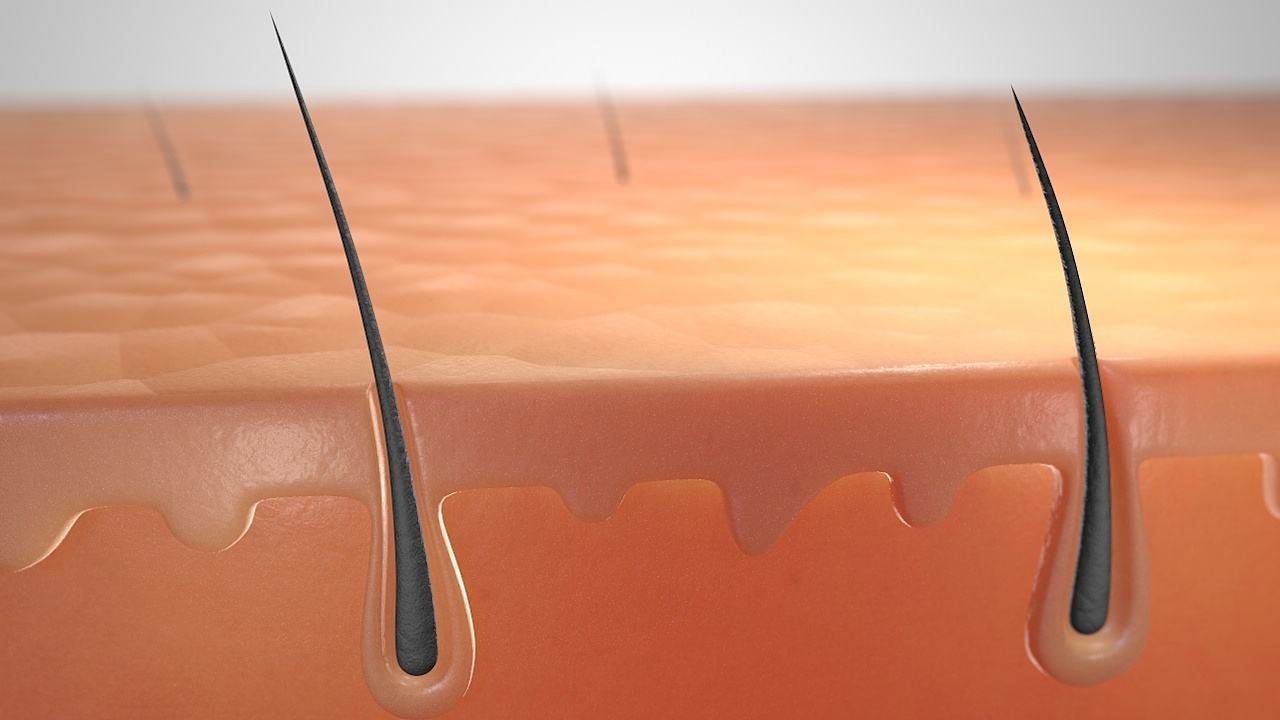 头皮上长红疙瘩脓包涂什么药膏,头皮上长红疙瘩脓包用什么药