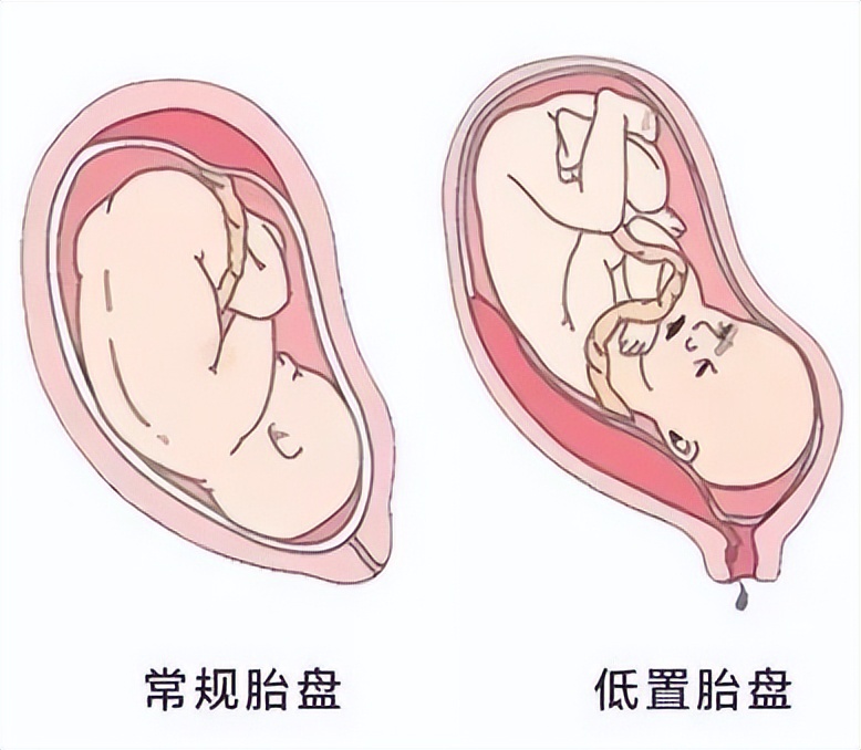 孕妈睡觉不老实怎么办,家有孕妇者一定要注意这六点