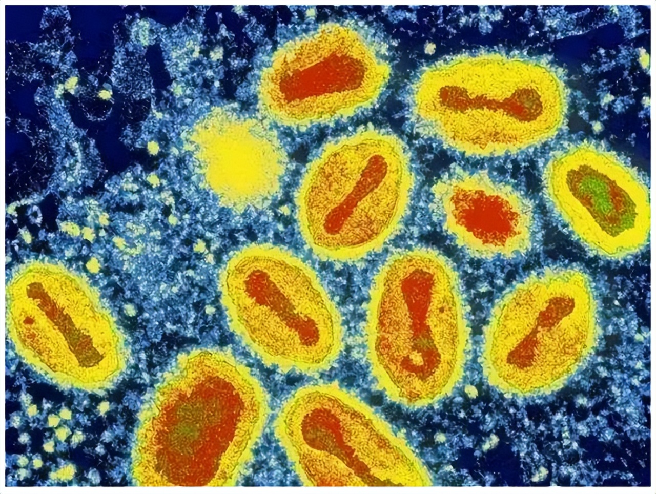 罗非鱼感染嗜水气单胞菌怎样治疗,罗非鱼病毒