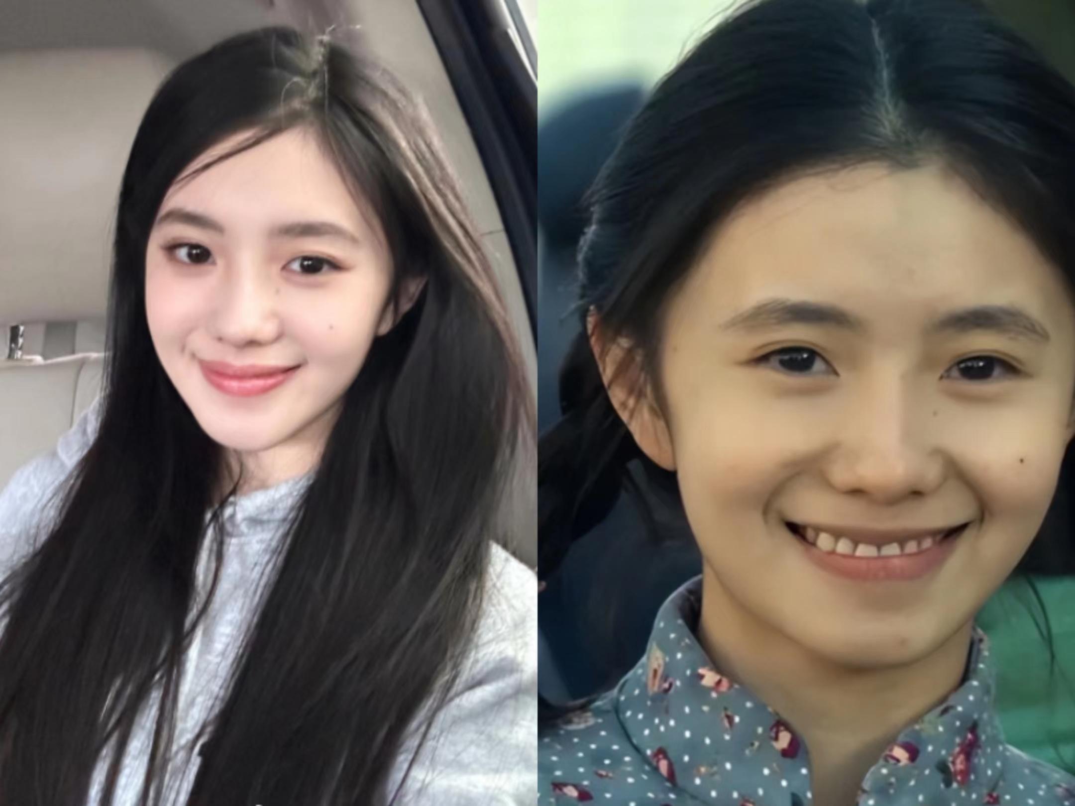 整容失败的女星蛇精脸,女星整容失败脸歪嘴斜