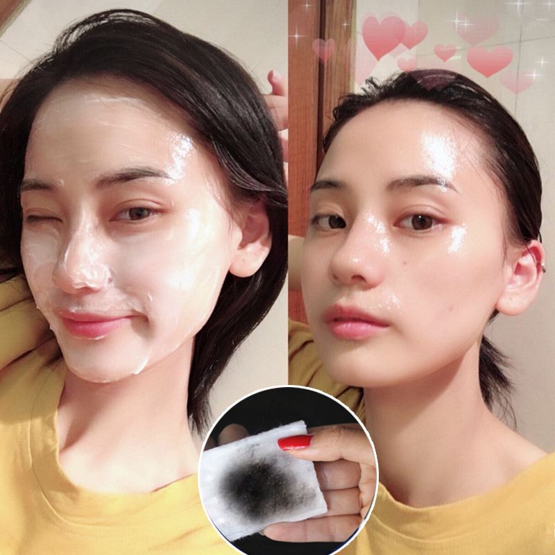 皮肤油毛孔粗大需要什么拯救,痘坑痘印毛孔粗大怎么拯救