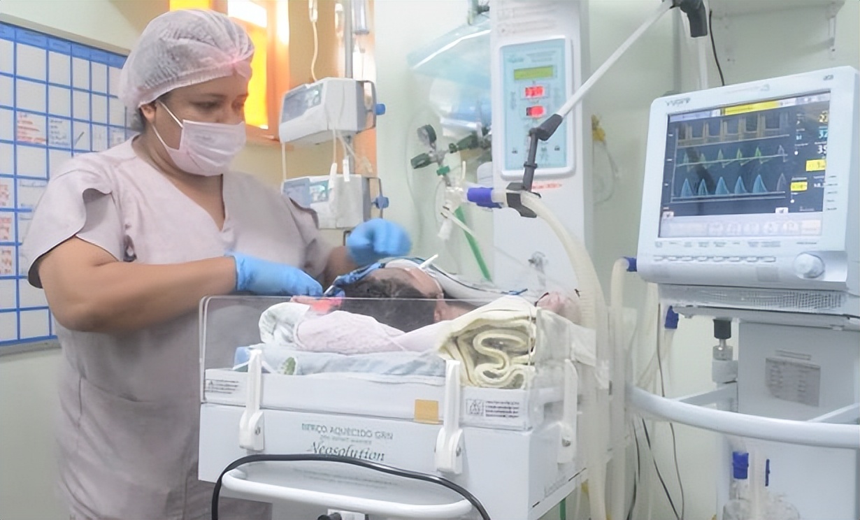 7公斤巨婴,巴西女子生下双头婴儿