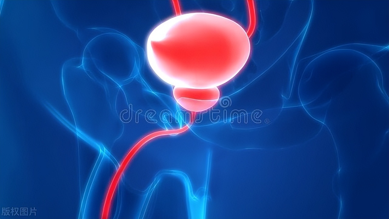 膀胱癌的原因膀胱癌是怎么引起的,膀胱癌的发病原因是什么