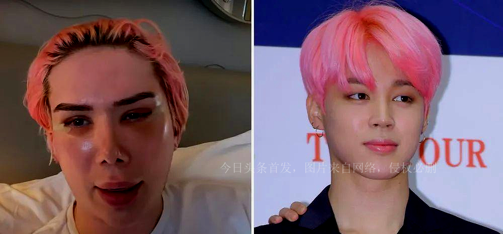 从男网红被骂丑后沉迷整容,白人网红整容18次