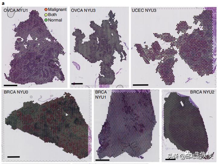 泛癌分析是怎么找到特定的基因的,癌细胞分析最新研究
