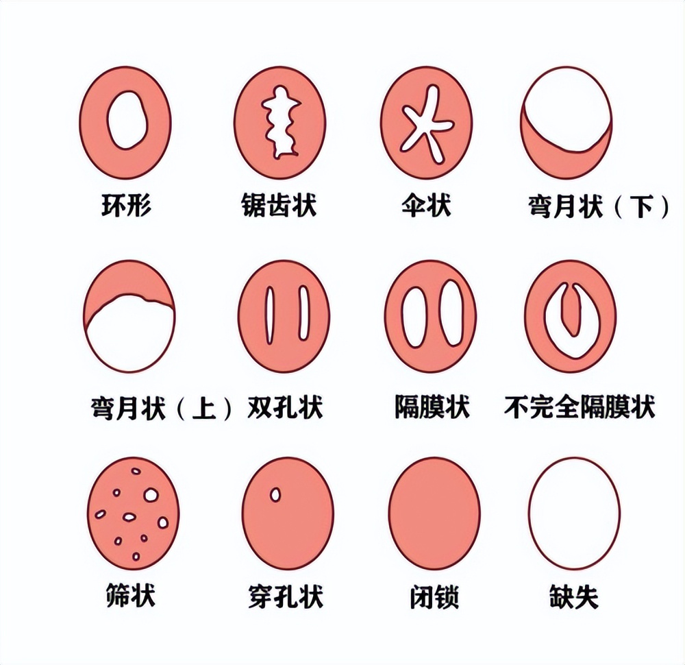 13岁女孩肠痉挛怎么回事,13岁女孩肠痉挛犯了怎么办