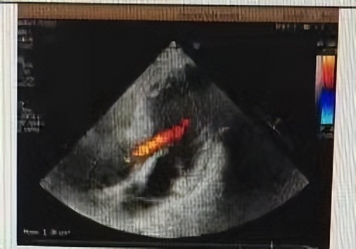 冠心病心梗用哪些中药能治愈,冠心病患者规范服药能避免心梗吗