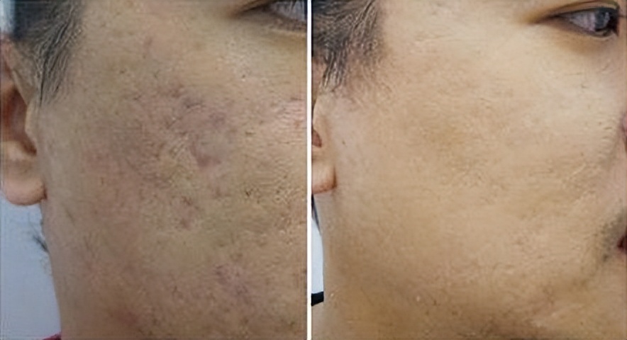 男士面部皮肤发红用什么护肤品,男士脸部皮肤干燥用什么护肤品