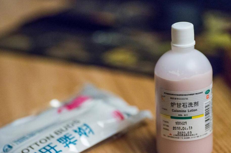 3块钱一瓶的炉甘石洗剂，连世卫组织都推荐，可以用来治哪些病？