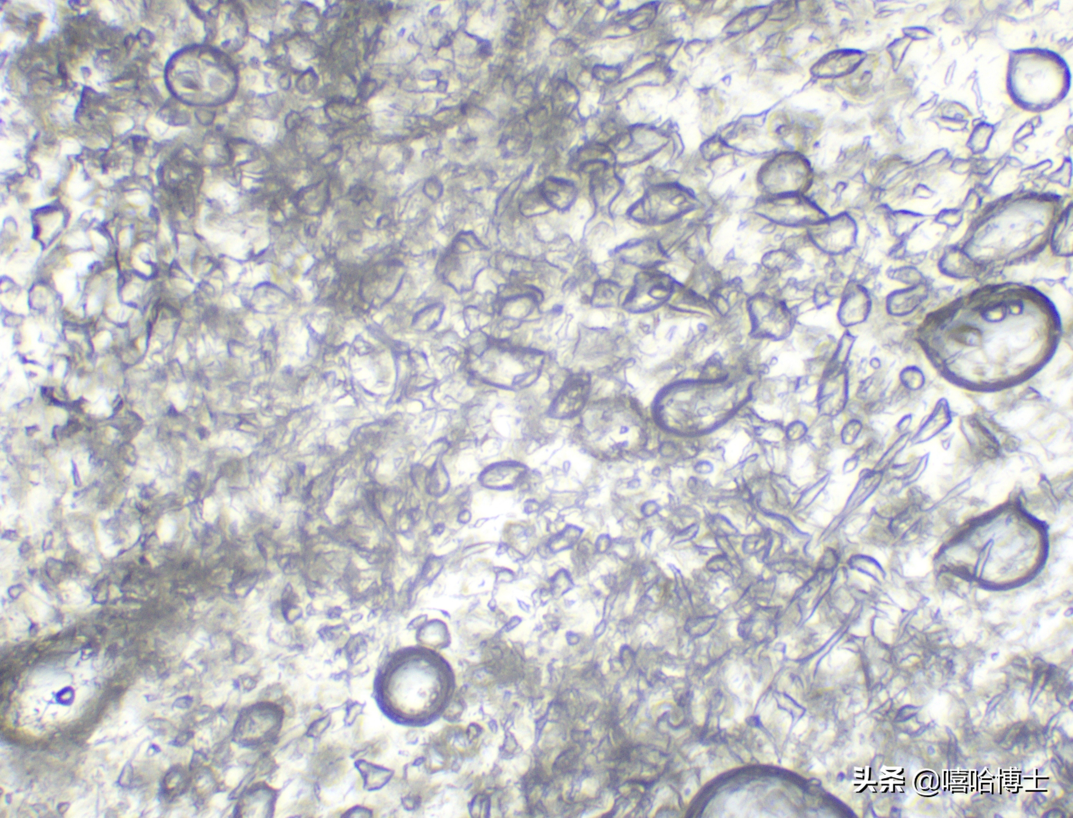 超级显微镜下的山竹,显微镜下的山竹果