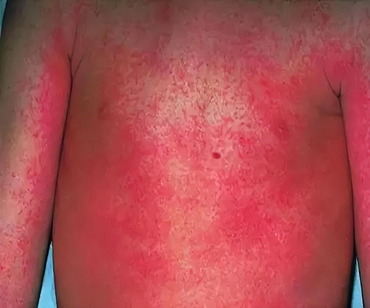 小儿舌头的各种症状如何解决,儿童舌头红色颗粒状怎么治疗