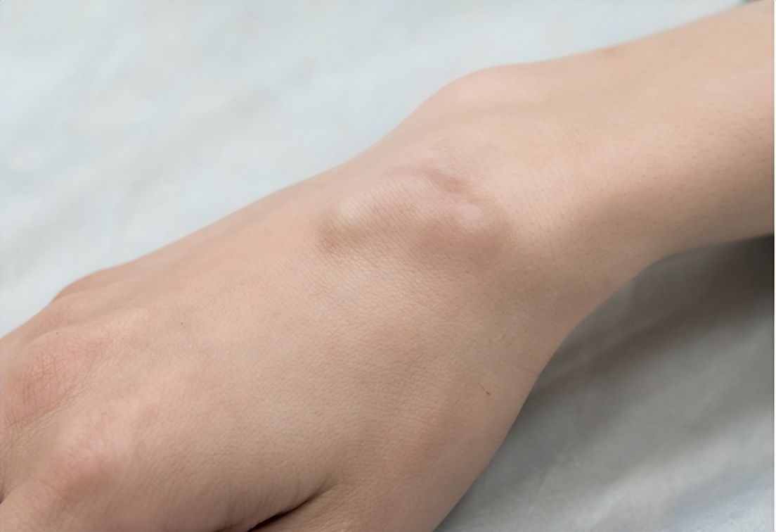 得过肿瘤的人还会再得么,得了肿瘤是不是就死定了