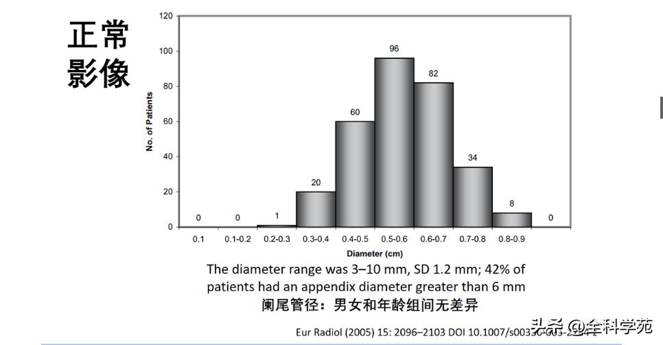 阑尾炎的讲解,关于阑尾炎的讨论总结