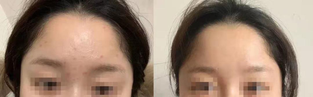 兰蔻极光焕白精华水乳小样,兰蔻极光水乳精华淡斑