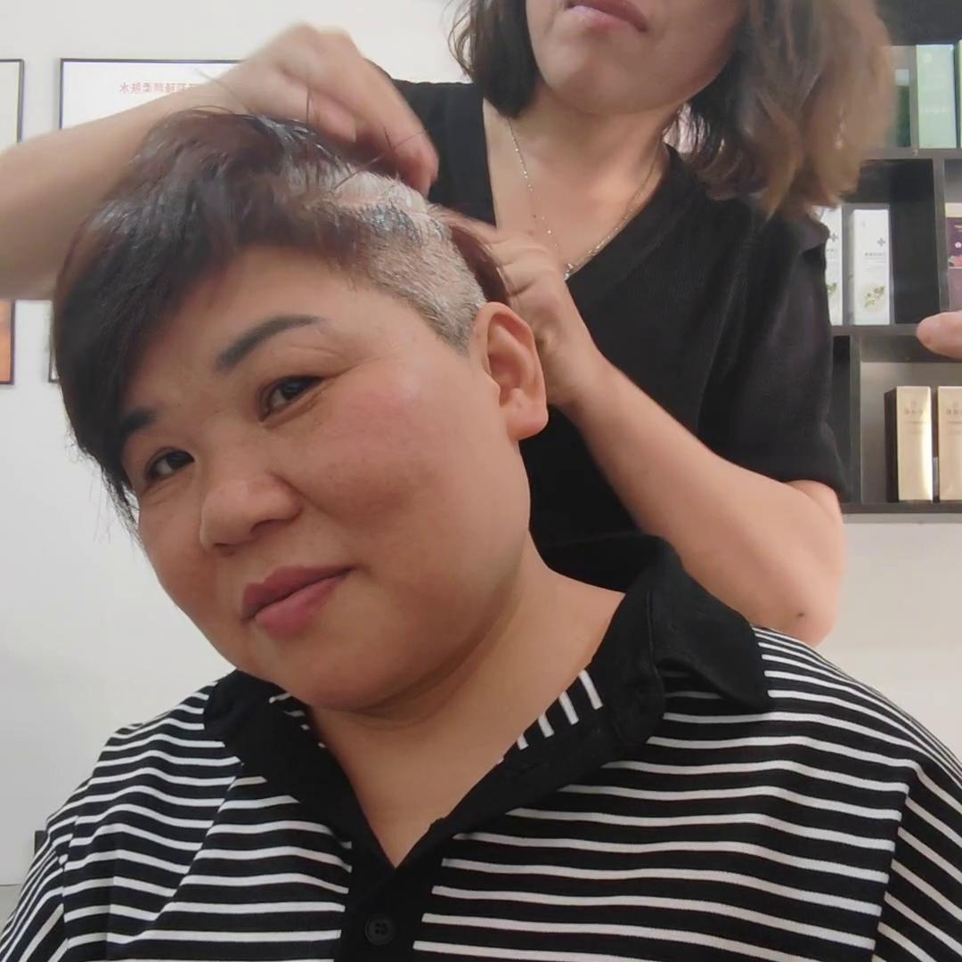 白头发看皮肤科吗,看白头发