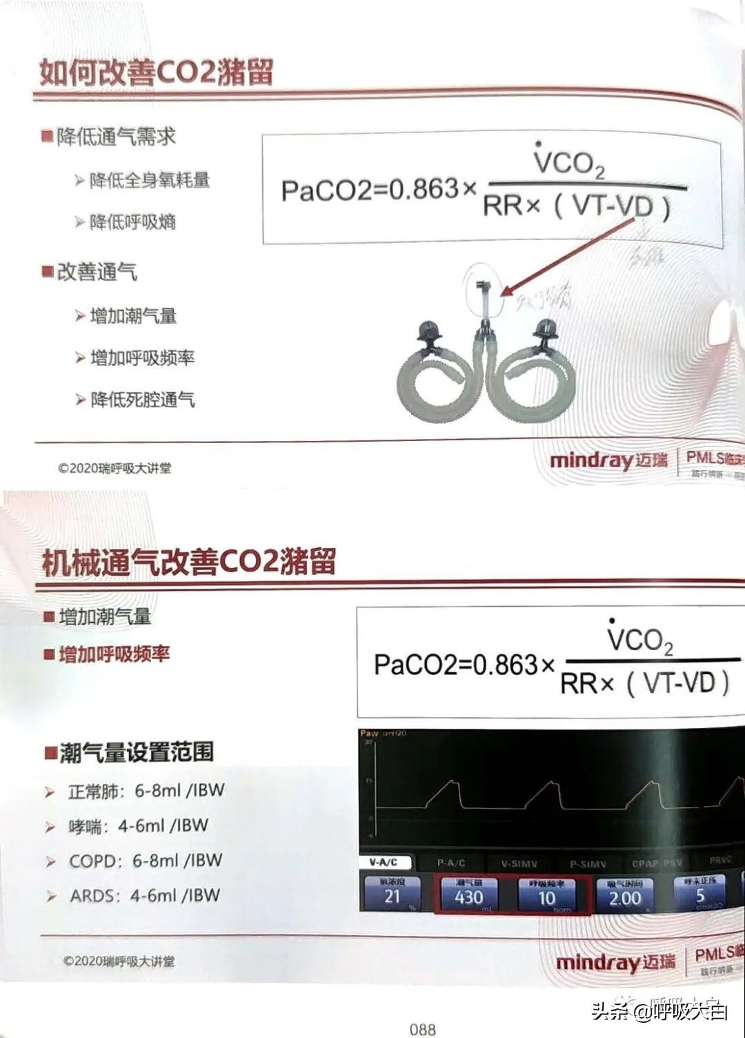 呼吸机epr怎么调节,呼吸机如何调节温度