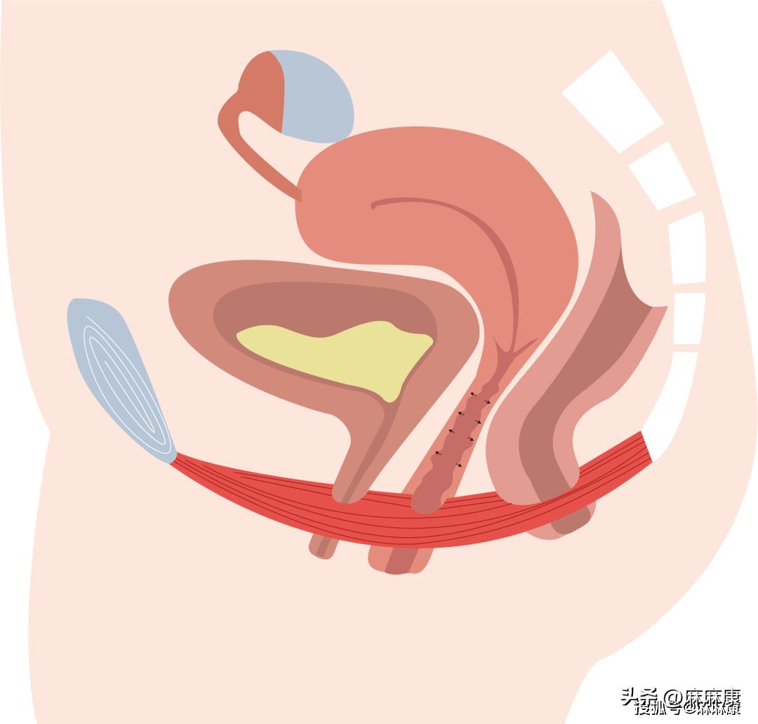 生育对身体的四大损伤！盆底肌常常被忽略