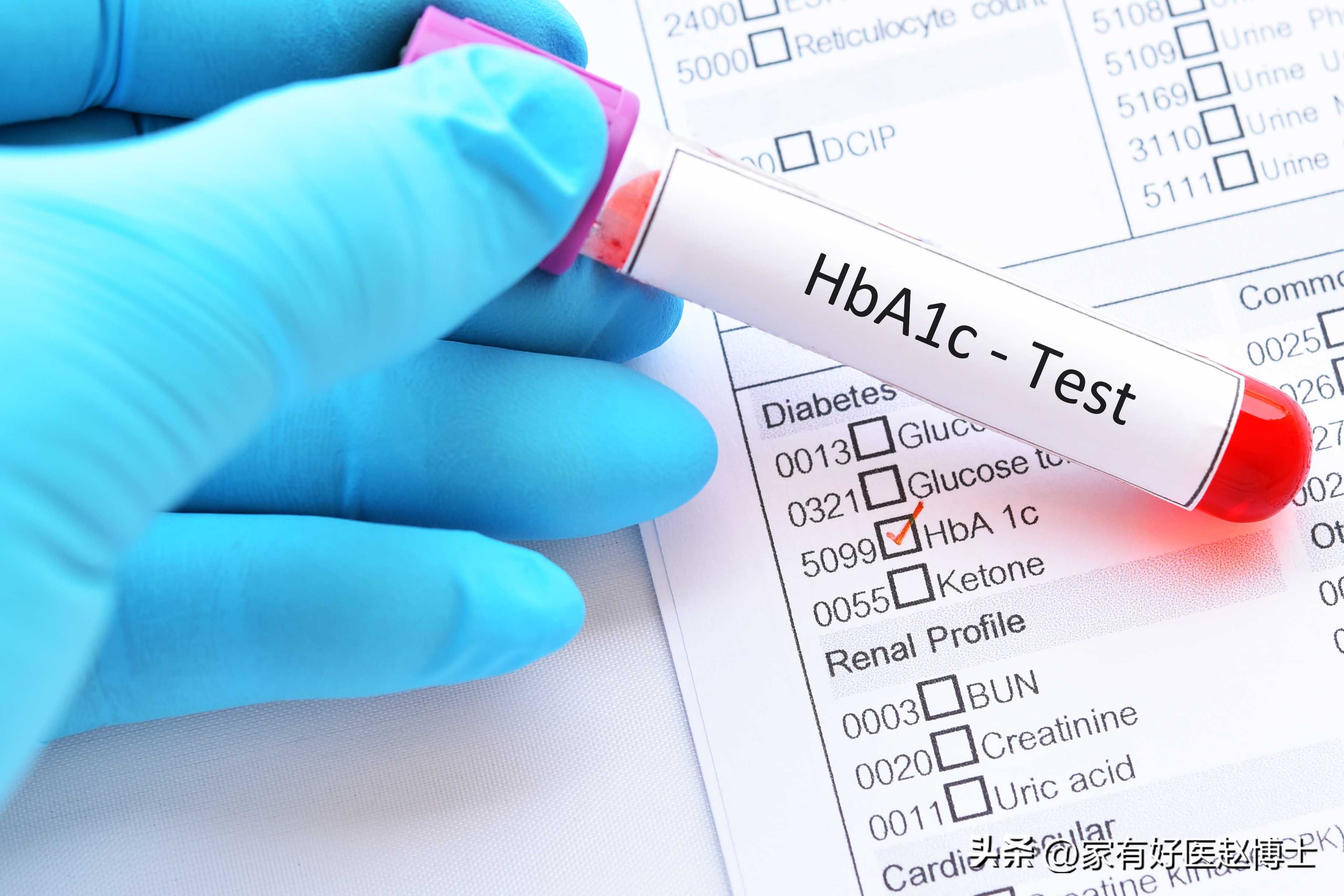 中国超过2亿人糖尿病,糖尿病人血糖100多严重吗