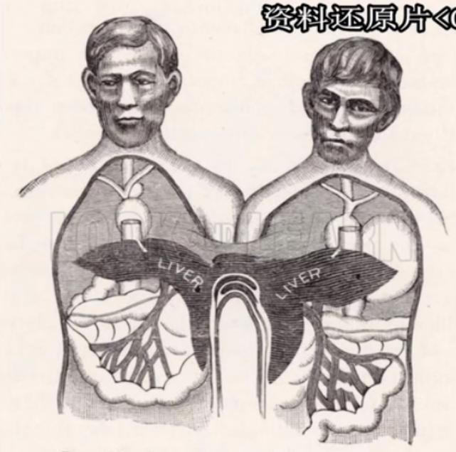 泰国连体兄弟娶美国姐妹,泰国连体兄弟娶双胞胎姐妹