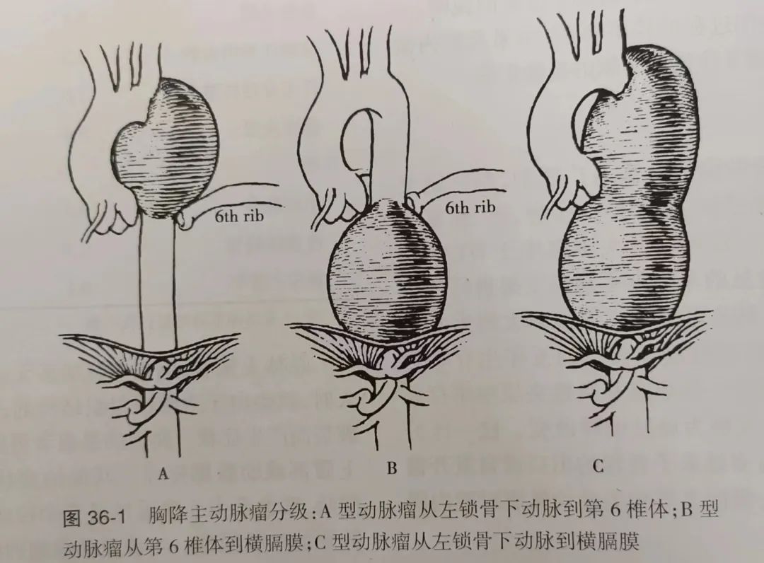 男子腹部剧痛检查意外肿瘤,男子腹痛难忍医生实施手术