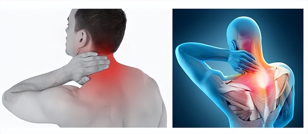 颈痛的最佳治疗方法,最近肩颈疼是什么病毒