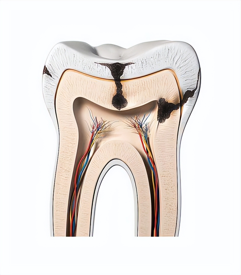 牙科恐惧症如何缓解,牙科焦虑症和牙科畏惧症