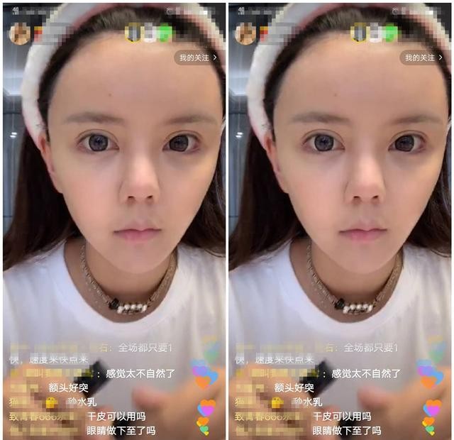 为了巴掌脸，把骨头削去一半，你害怕吗？