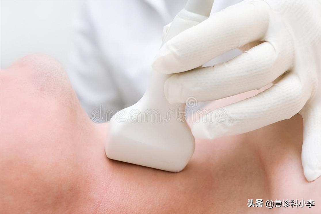 甲状腺实性结节4a癌变几率有多大,长了甲状腺结节癌变的几率有多大