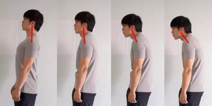 脊椎骨质疏松喝什么钙片好,经常腰腿酸痛吃什么补钙产品