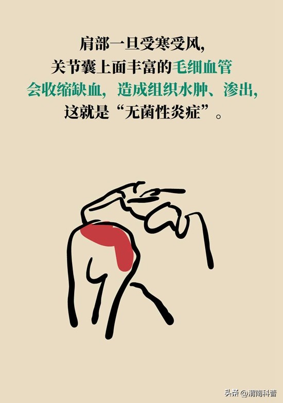 肩膀不抻不疼一抻就疼,肩膀往后伸疼