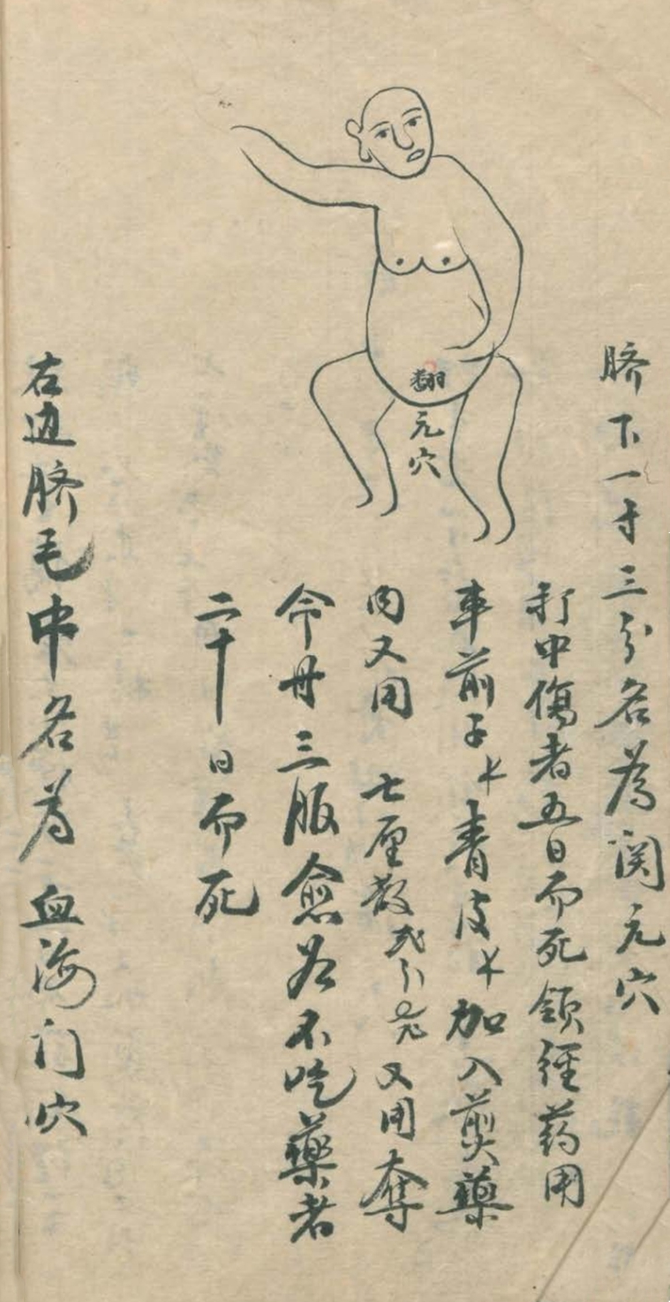 武当秘传跌打八法,民间中医古籍手抄本专医跌打秘方