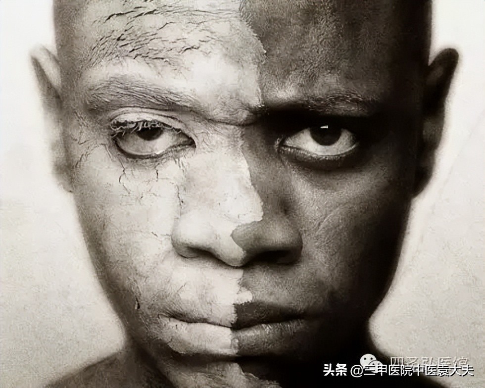 中医专治抑郁症的方法,中医治疗焦虑抑郁症彻底根除案例