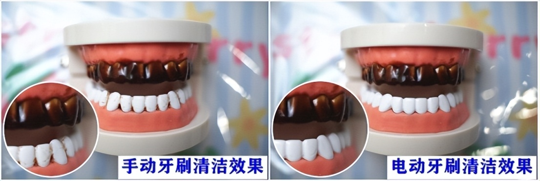 飞利浦电动牙刷推荐评测2023,usmile和飞利浦的电动牙刷哪个好用