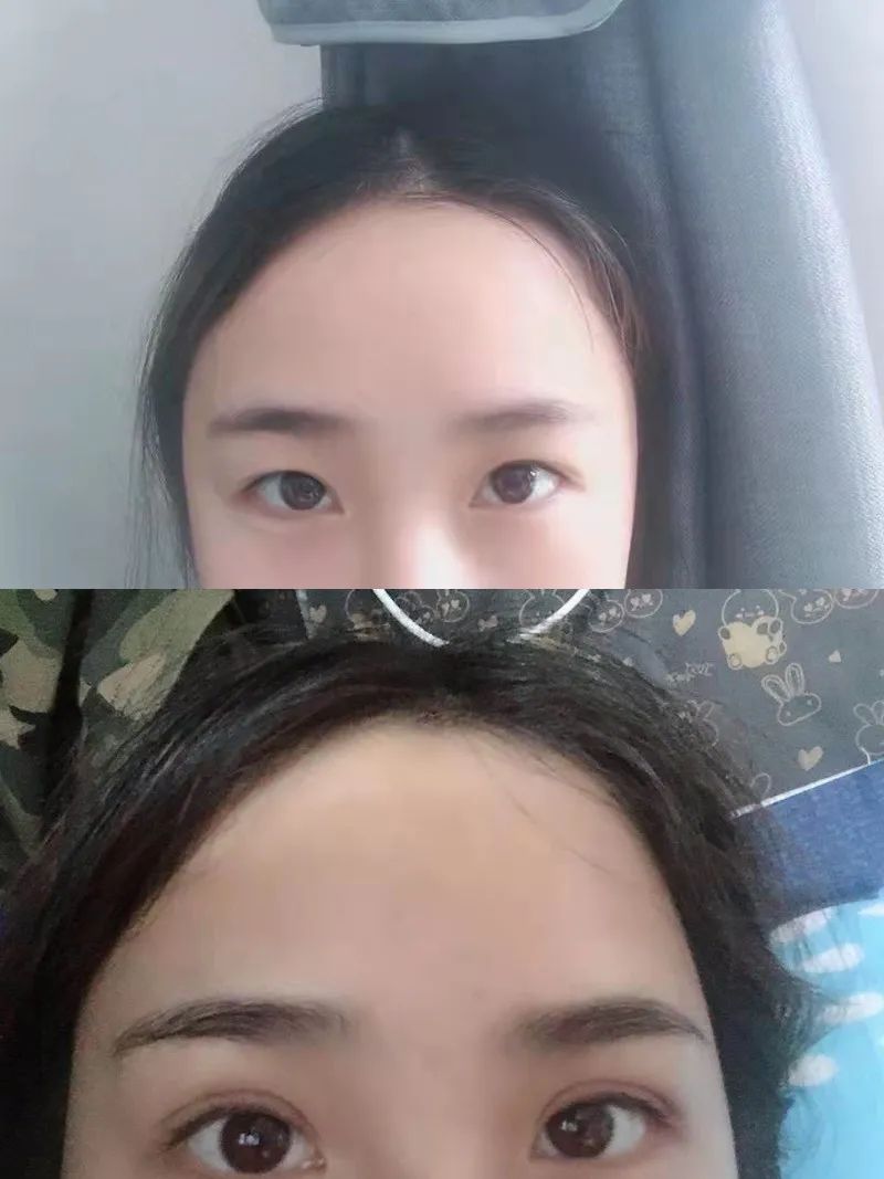 美丽双眸，轻松拥有，让心灵之窗绽放光彩！这些优惠也别错过哦