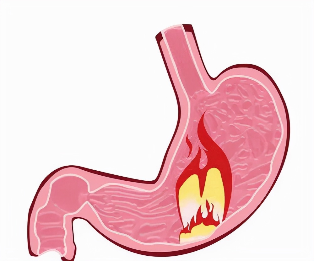 消化不良怎么治疗最快最有效,消化不良怎么调理最简单方法