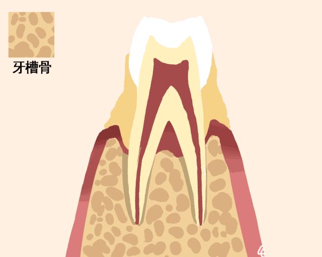 牙齿松了怎么补救最快,牙齿松了能补救吗