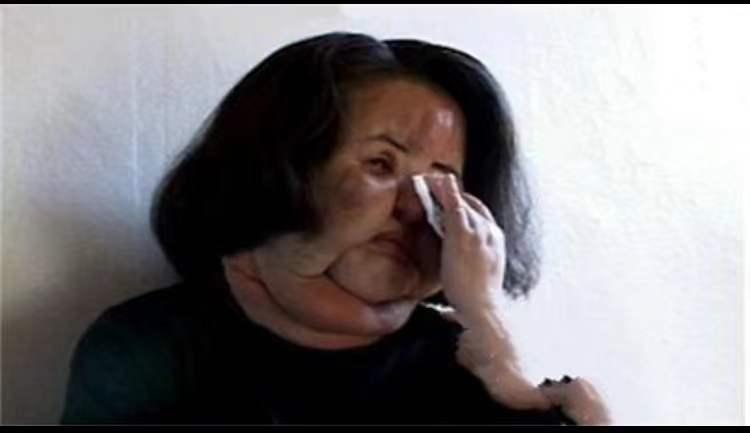 韩慧景整容是打了玻尿酸了吗,2004年整容狂魔韩慧景的故事