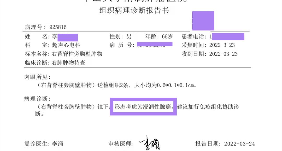 彭齐荣教授视频,专家说早期肺腺癌