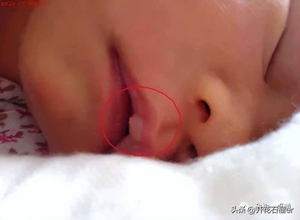 新生儿这28个异常表现都是正常的,新生儿值得注意的各种症状