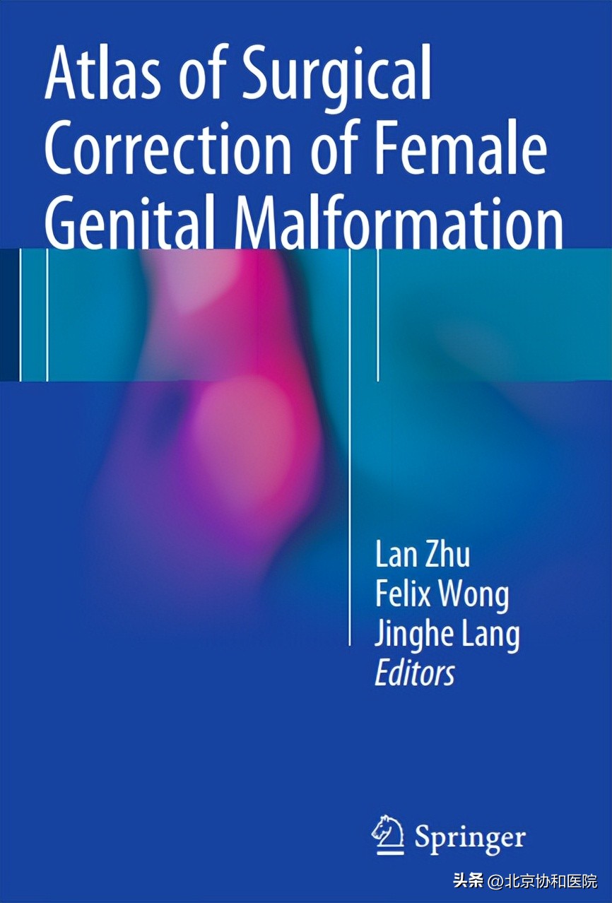 协和医院在ScienceBulletin发表先天性子宫颈发育不良诊断及手术治疗新观点