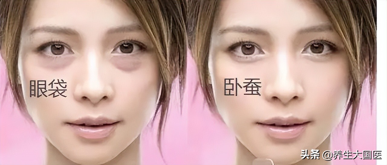 对付眼袋有良方,中年人的眼袋2分钟解决