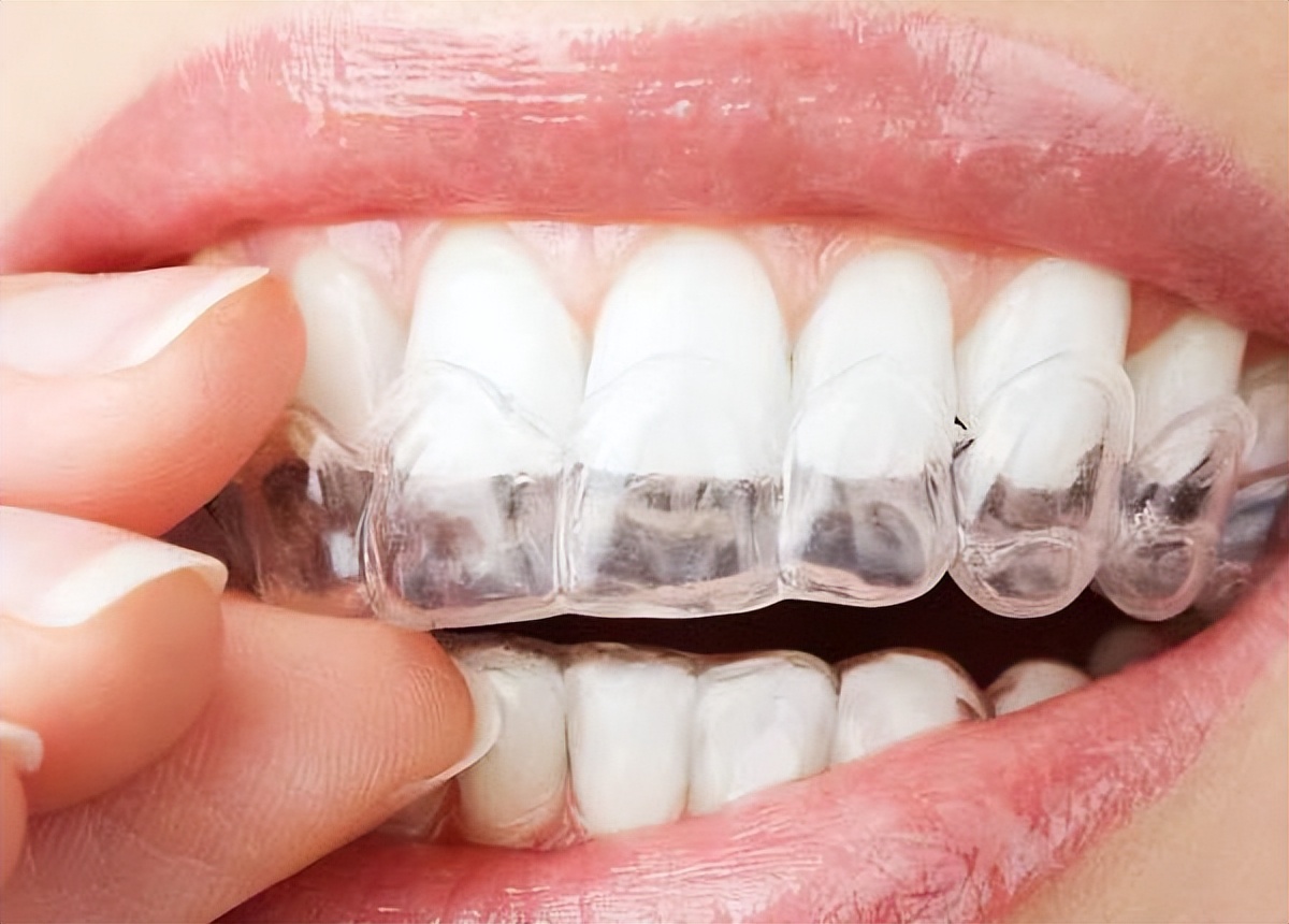 哪些人群不宜使用电动牙刷,成人电动牙刷的实用性