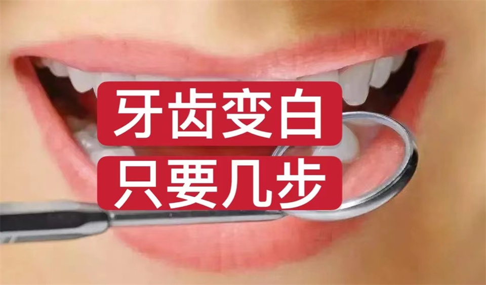 快速去牙渍牙垢牙黄的神器,牙黄牙渍怎么刷掉小妙招