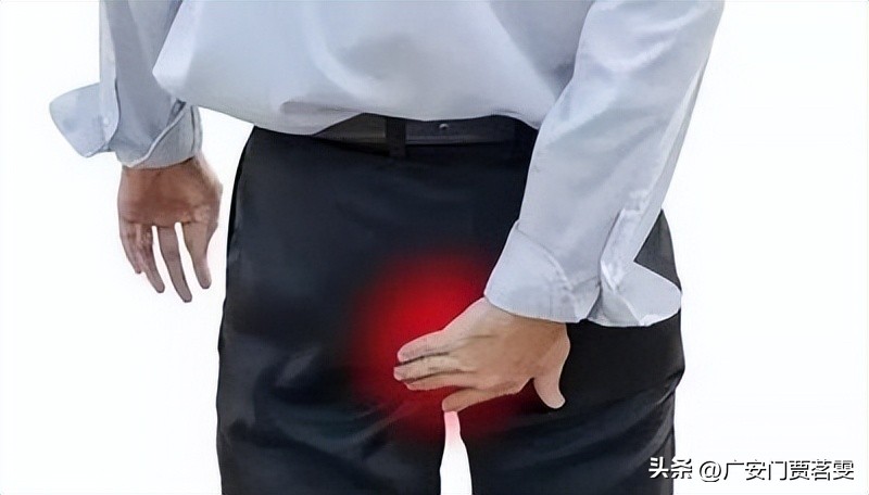 得了肛门瘙痒症应该如何预防,肛门瘙痒症科普