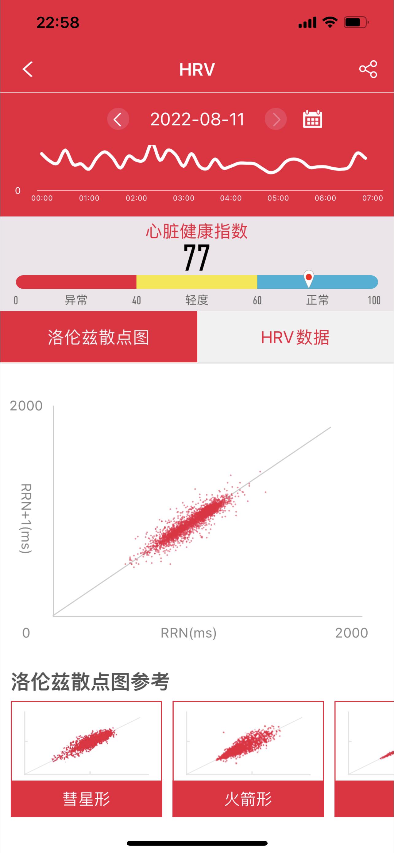 运动监测血压手表推荐,dido智能手表g28spro