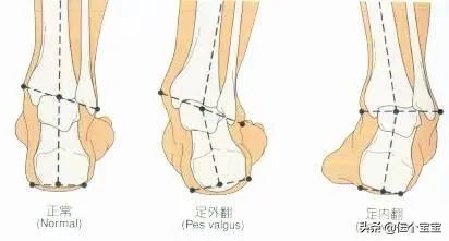 网红踩屎感洞洞鞋防滑,儿童踩屎感椰子鞋